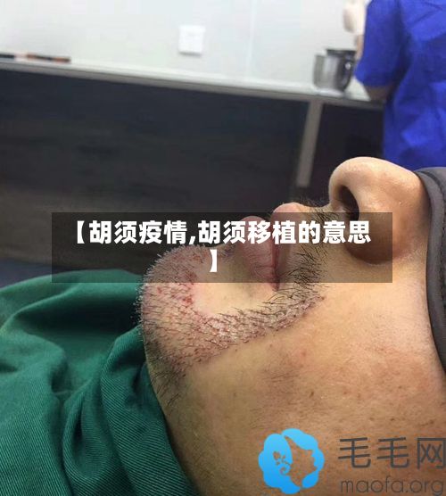 【胡须疫情,胡须移植的意思】