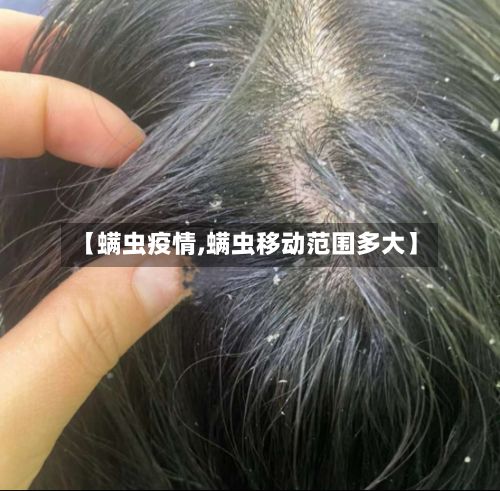 【螨虫疫情,螨虫移动范围多大】