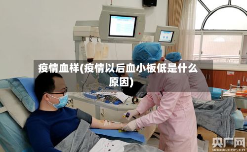 疫情血样(疫情以后血小板低是什么原因)-第2张图片