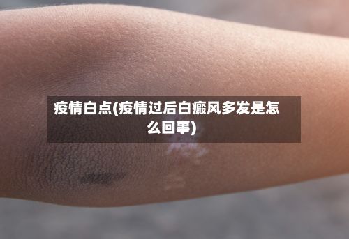 疫情白点(疫情过后白癜风多发是怎么回事)-第2张图片