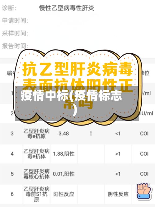 疫情中标(疫情标志)